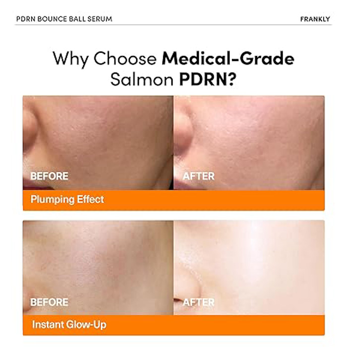 FRANKLY SALMON PDRN BOUNCE BALL SERUM 30ML