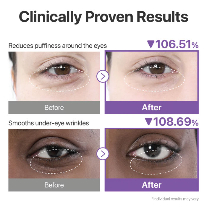NUMBUZIN NO.9 EYE PATCHES , NAD+ COLLAGEN