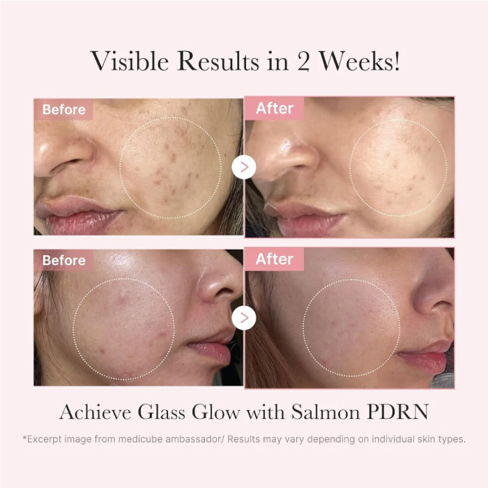 MEDICUBE PDRN GLOW KIT