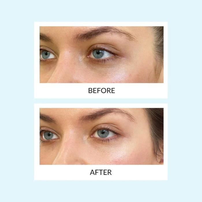 TALIKA PARIS EYE THERAPY PATCH