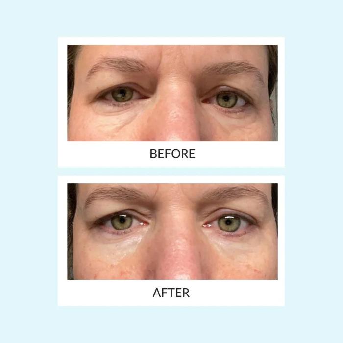 TALIKA PARIS EYE THERAPY PATCH